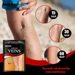 Visszér elleni tapasz – 12 db