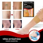 Visszér elleni tapasz – 12 db