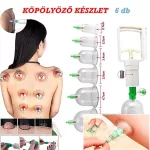 6 részes vákuumterápiás köpölyöző készlet – fájdalomcsillapításhoz, izomlazításhoz